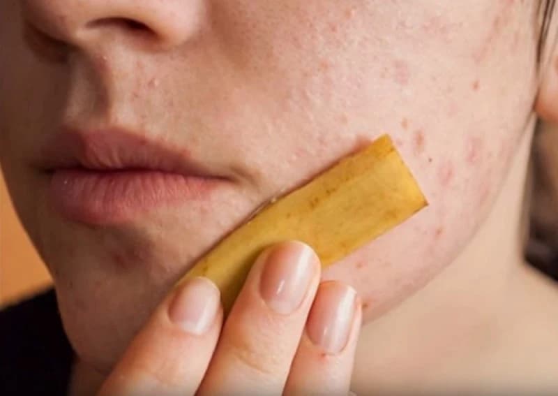 25 Uses of Banana Peels you Probably Ignored