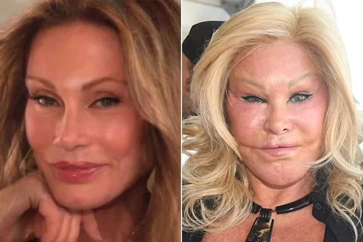 Are Celebrity Transformations Always For The Best? See The Biggest Stars’ Before-And-After Pictures