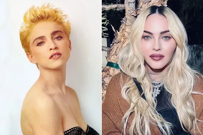 Are Celebrity Transformations Always For The Best? See The Biggest Stars’ Before-And-After Pictures