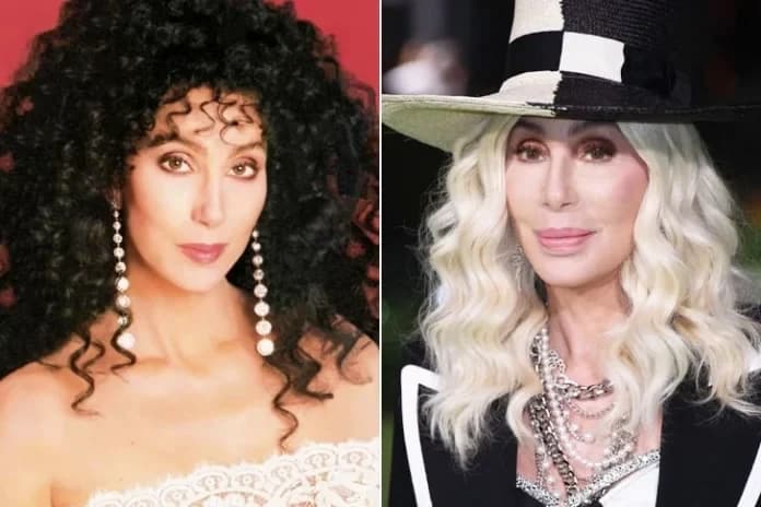 Are Celebrity Transformations Always For The Best? See The Biggest Stars’ Before-And-After Pictures