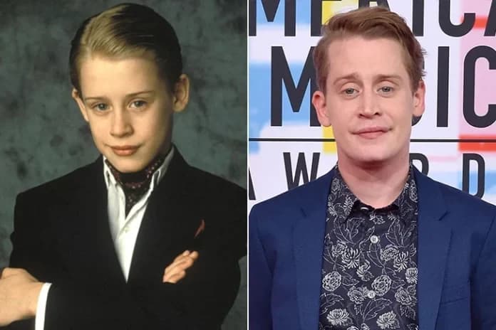 Are Celebrity Transformations Always For The Best? See The Biggest Stars’ Before-And-After Pictures