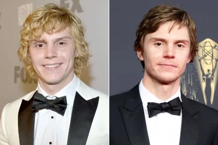 Are Celebrity Transformations Always For The Best? See The Biggest Stars’ Before-And-After Pictures