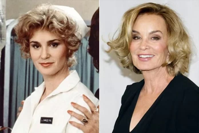 Are Celebrity Transformations Always For The Best? See The Biggest Stars’ Before-And-After Pictures