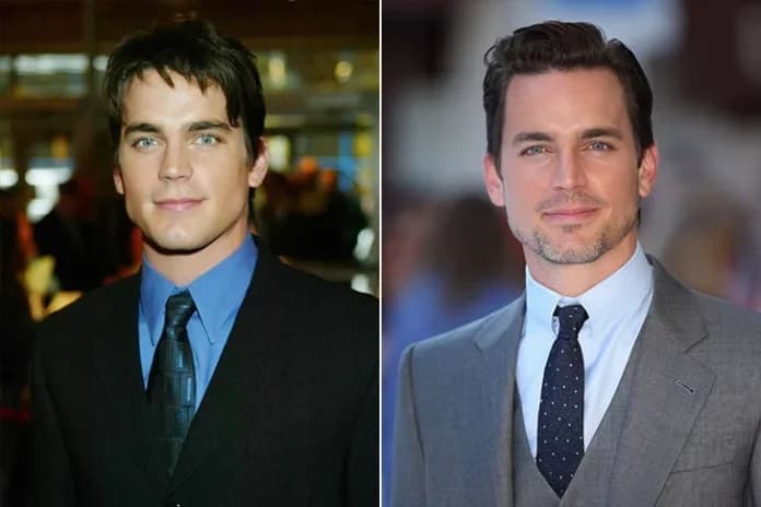 Are Celebrity Transformations Always For The Best? See The Biggest Stars’ Before-And-After Pictures