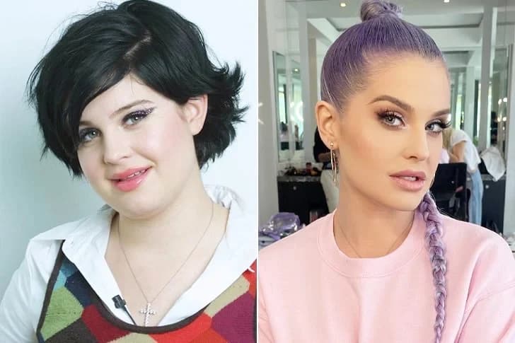 Are Celebrity Transformations Always For The Best? See The Biggest Stars’ Before-And-After Pictures
