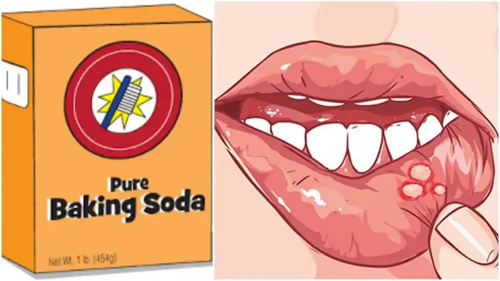 Baking Soda