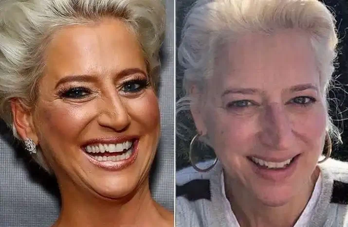 Dorinda Medley