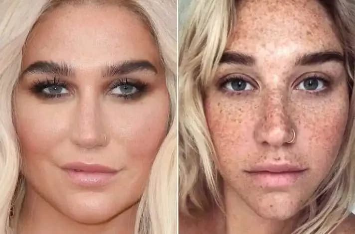 Kesha