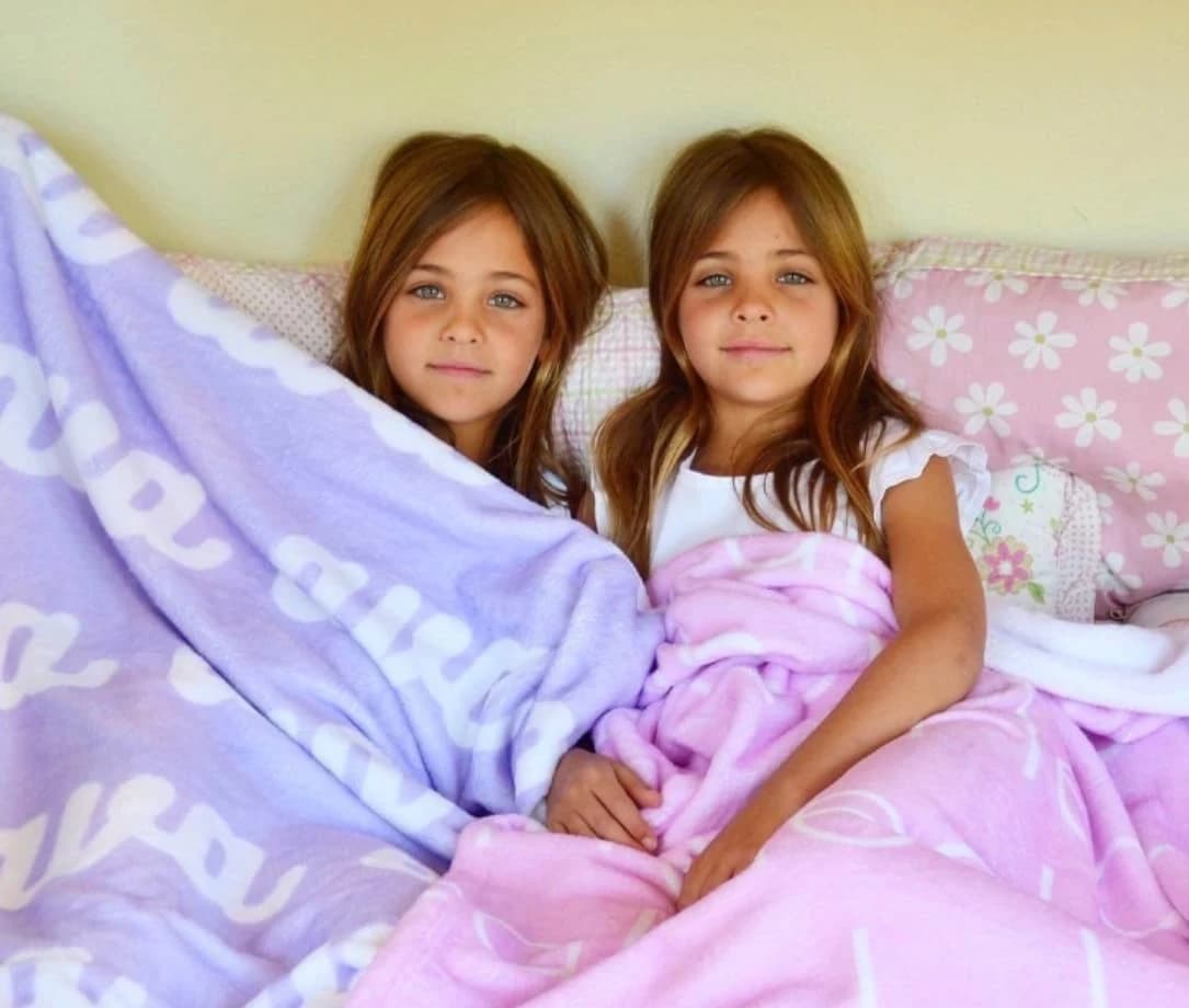 They were considered the most beautiful twins in the world: but what happened to the beautiful girls?