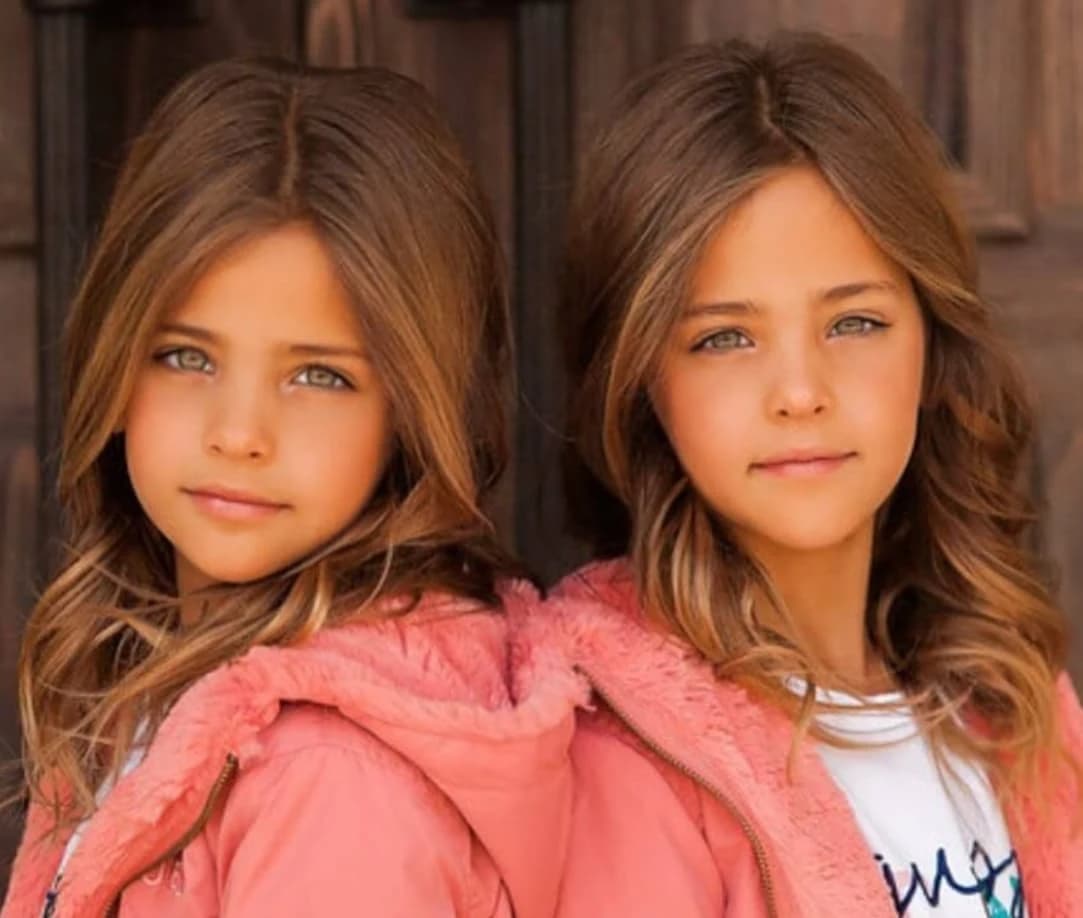 They were considered the most beautiful twins in the world: but what happened to the beautiful girls?