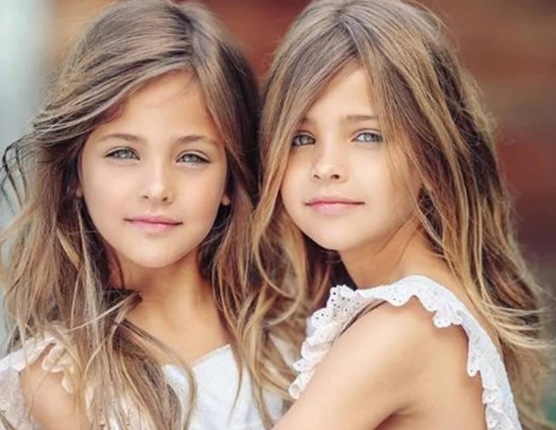 They were considered the most beautiful twins in the world: but what happened to the beautiful girls?