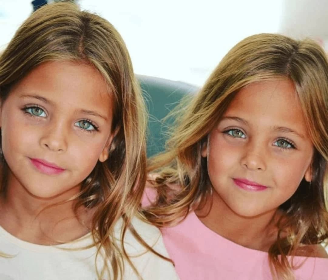 They were considered the most beautiful twins in the world: but what happened to the beautiful girls?