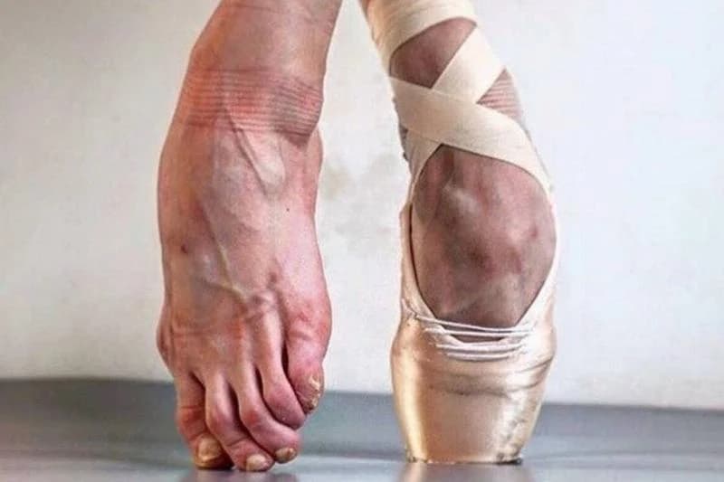 feet